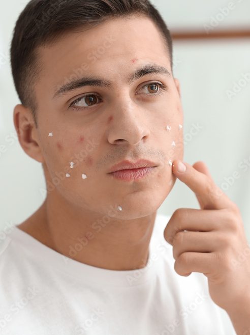 Portrait of young man using remedy for acne at home