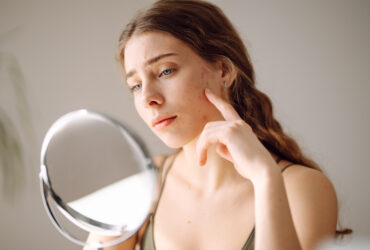 Expert Acne Treatments You Can Only Get From a Dermatologist
