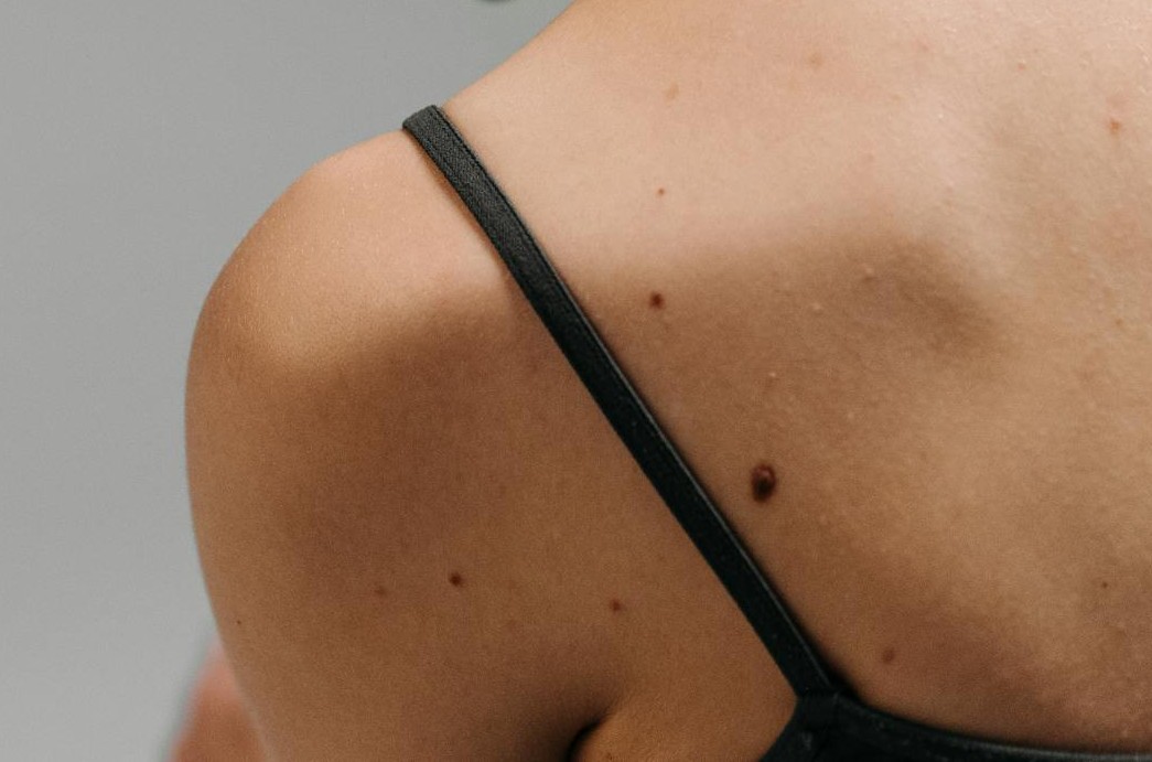 what is skin cancer biopsy