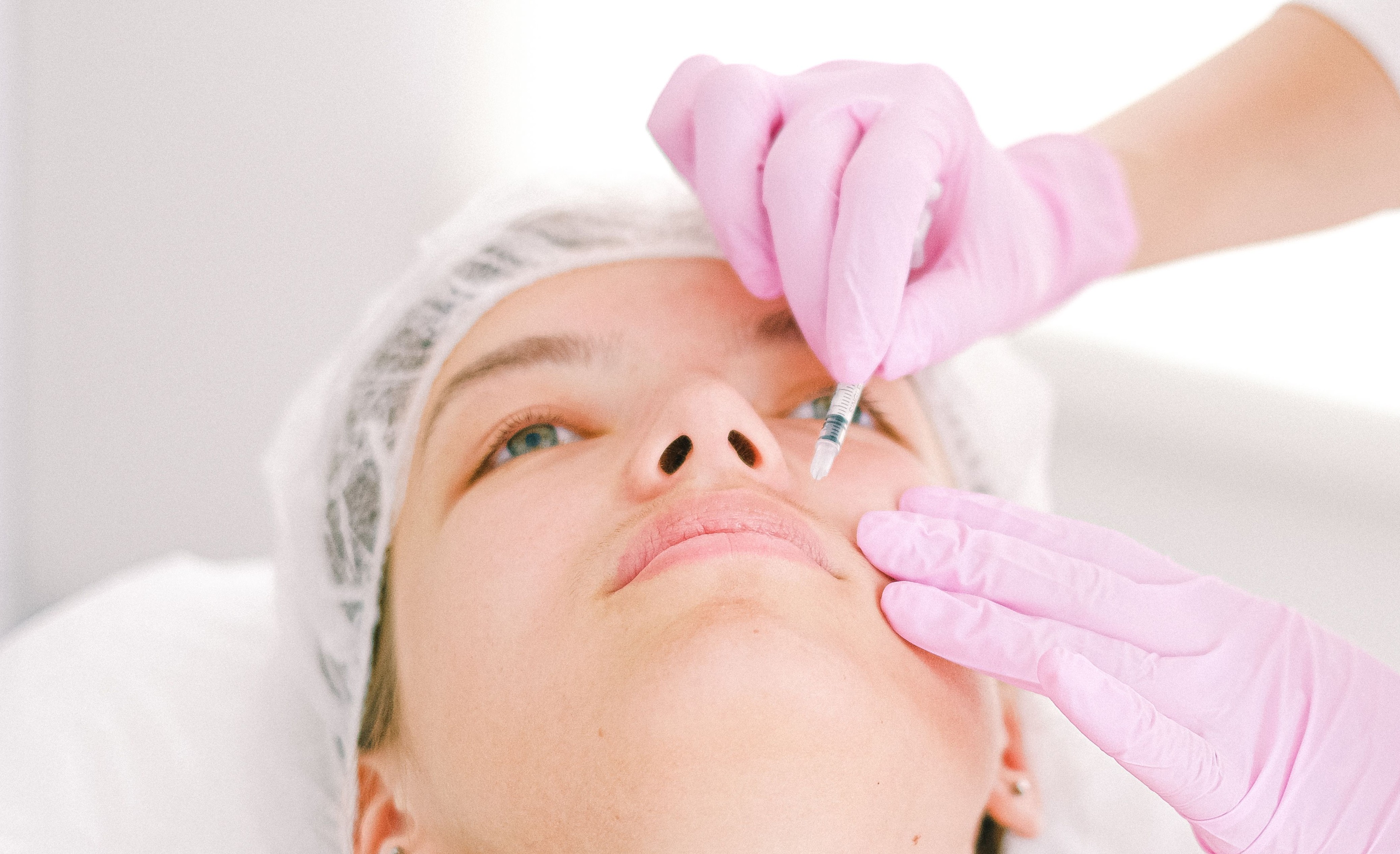 nasolabial fillers procedure